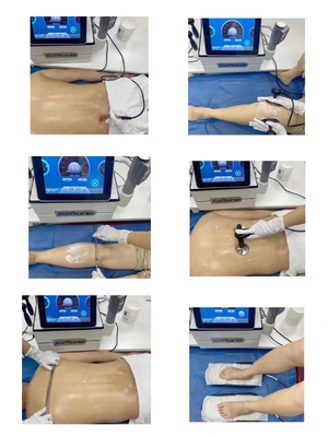 Machine portative de thérapie de Tecar d'onde de choc du vide SME pour le traitement facial/dysfonctionnement érectile/soulagement de la douleur/réadaptation