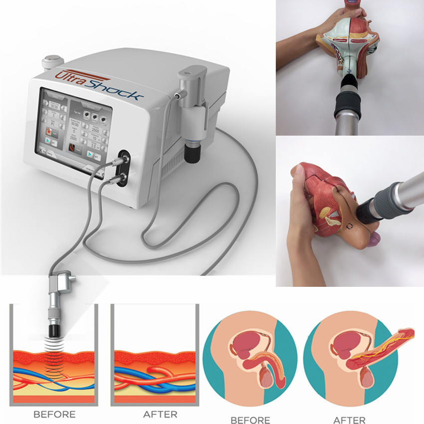 Machine de physiothérapie d'ultrason d'onde de choc pour le soulagement de la douleur de corps